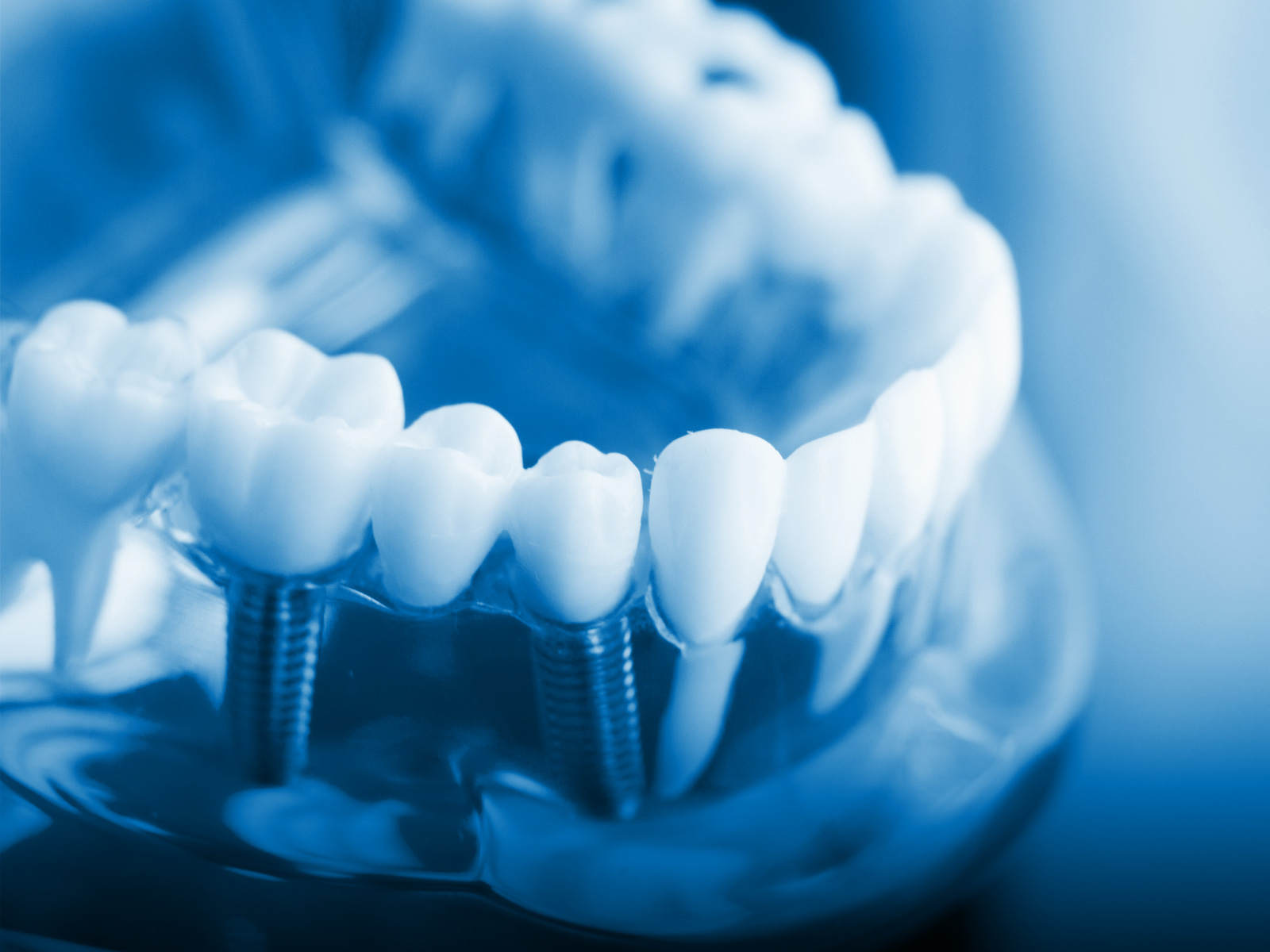 نرم افزار مدیریت لابراتوار دندانسازی
